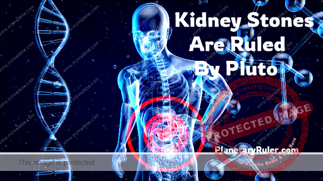 Kidney Stones