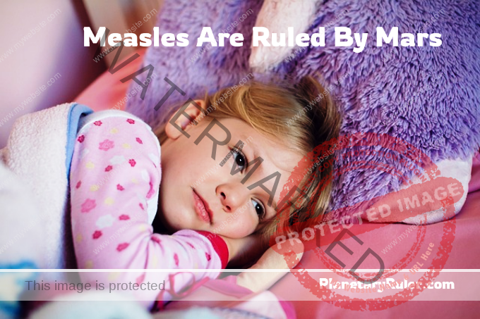 measles